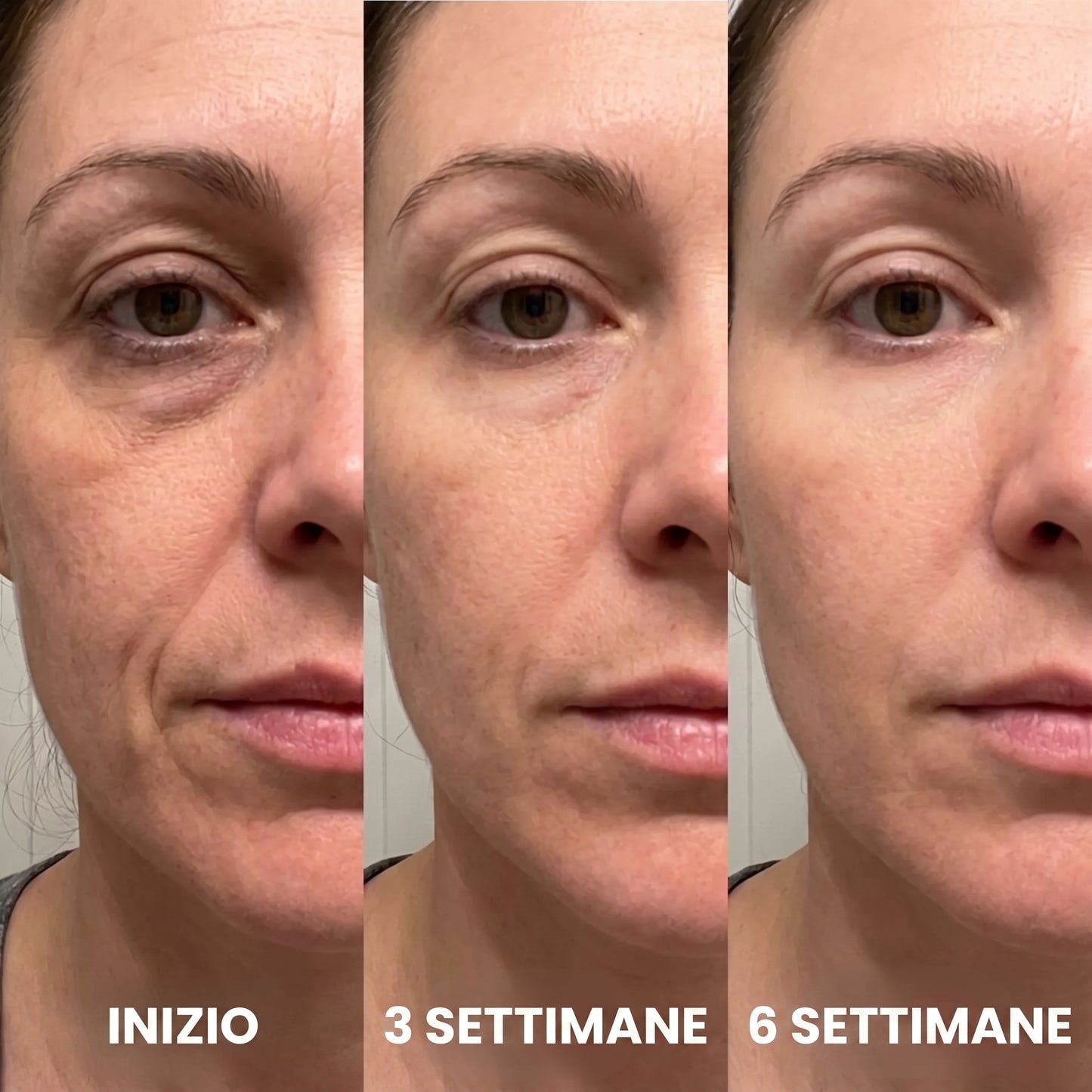Collagene Stick con PDRN